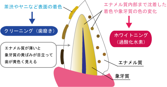 神保町駅より徒歩1分、神保町野本歯科医院のホワイトニング