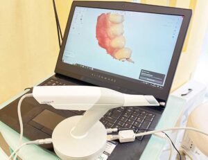 神保町の歯医者、神保町野本歯科医院で、嘔吐反射のあるの方のための歯科治療について解説