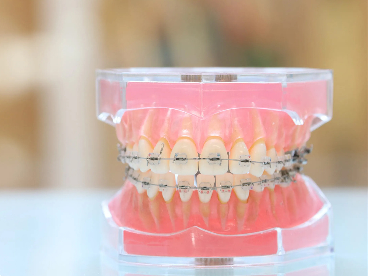 矯正歯科 - 神保町の歯医者なら、駅徒歩1分、神保町野本歯科医院