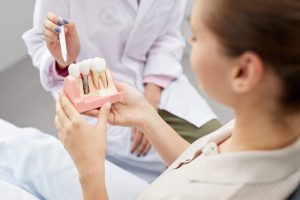 神保町の歯医者、神保町野本歯科医院でセカンドオピニオンについての解説