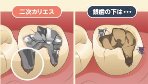 神保町駅徒歩1分の歯医者、神保町野本歯科医院で、歯茎を触ると臭い原因と対策についての解説