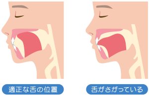 神保町の歯医者、神保町野本歯科医院で口角に泡がたまる原因と対策について解説