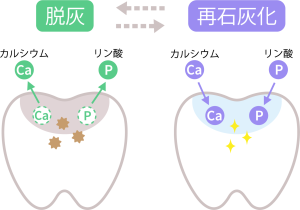 神保町野本歯科医院で、「食後30分以内の歯磨きはNG」は本当？嘘？待つべき人、すぐに磨くべき人の違いについて解説