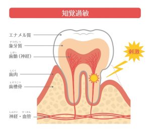 神保町の歯医者なら、駅徒歩1分、神保町野本歯科医院で歯の痛みのタイプについて解説