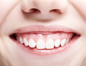 神保町野本歯科医院で前歯が大きいと悩む方へ：原因と治療法を徹底解説について解説