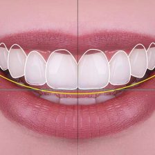 神保町野本歯科医院で前歯が大きいと悩む方へ：原因と治療法を徹底解説について解説