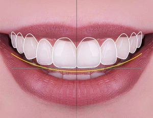 神保町野本歯科医院で前歯が大きいと悩む方へ：原因と治療法を徹底解説について解説