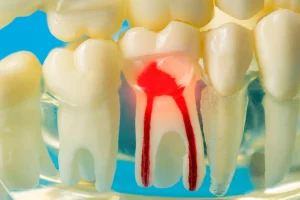 神保町野本歯科医院でお酒を飲むと歯や歯ぐきがズキズキ痛む原因は？当日・翌日の痛みのメカニズムと対処法について解説