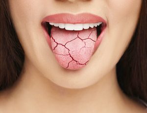 神保町野本歯科医院で唇が歯にくっつく原因と対策について解説