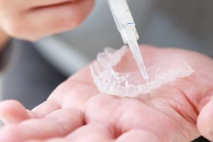 神保町野本歯科医院でホームホワイトニングの正しいやり方と注意点について解説