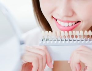 神保町野本歯科医院でホームホワイトニングの正しいやり方と注意点について解説