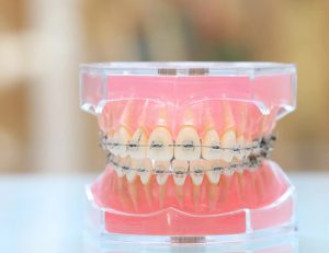 神保町野本歯科医院で前歯が大きいと悩む方へ：原因と治療法を徹底解説について解説