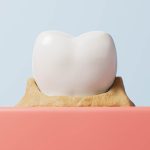 神保町野本歯科医院で、自分で歯石を取る方法について解説