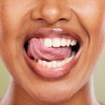 神保町野本歯科医院で唇が歯にくっつく原因と対策について解説