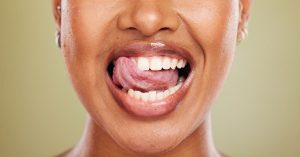神保町野本歯科医院で唇が歯にくっつく原因と対策について解説