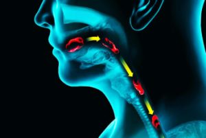 神保町野本歯科医院で、若年層の誤嚥性肺炎について解説