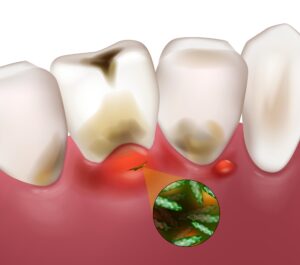 神保町野本歯科医院で、OL・サラリーマンのための「失敗しない歯医者選び」5つの重要ポイントについて解説