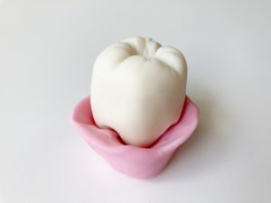 神保町の歯医者、神保町野本歯科医院で、奥歯の歯茎がめくれる原因について解説