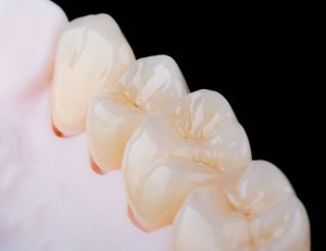 神保町の歯医者、神保町野本歯科医院で、被せ物をした歯が臭い原因について解説