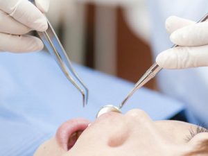 神保町野本歯科医院で銀歯を白い歯に変えるデメリットとは？意外なリスクと後悔しないための選択肢について解説