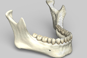 神保町の歯医者、神保町野本歯科医院で【2026年最新】インプラントは保険適用できる？条件と費用を賢く抑える「医療費控除」完全ガイドについて解説