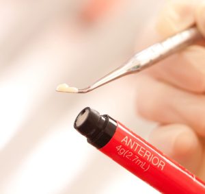 神保町の歯医者、神保町野本歯科医院でダイレクトボンディングとコンポジットレジン、何が違うの？適応症例は？について解説