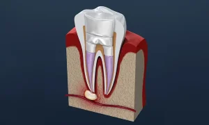 神保町の歯医者、神保町野本歯科医院で「歯がたまに痛い」のはなぜ？「間欠的な痛み」の原因と対策について解説