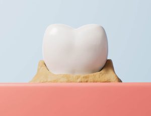 神保町の歯医者、神保町野本歯科医院で、10代の歯ぐきの腫れは「思春期性歯肉炎」かも？成長期のホルモンと歯周病の関係について解説